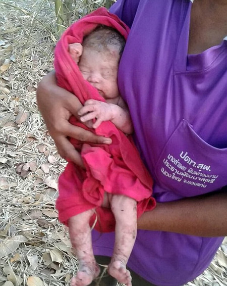 La historia del bebé milagro que sobrevivió tras ser apuñalado y enterrado (y ya ha sido adoptado)