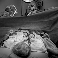 La asombrosa historia de una mujer que se quedó embarazada dos veces en diez días, ¿con una sola relación sexual? 