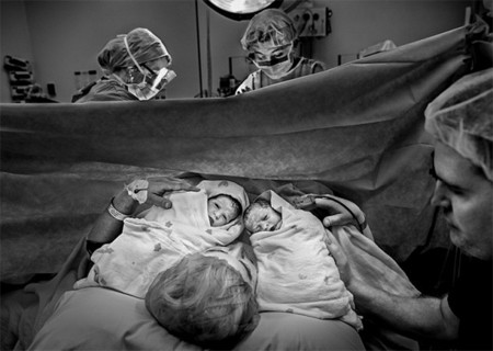 La asombrosa historia de una mujer que se quedó embarazada dos veces en diez días, ¿con una sola relación sexual?