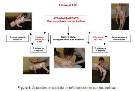Actuación ante un niño consciente