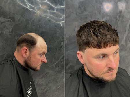 peluquin masculino solucion calvicie