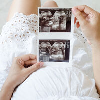 Ecografía de las 12 semanas: qué se observa en el ultrasonido del primer trimestre 