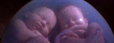 Casos raros de gemelos