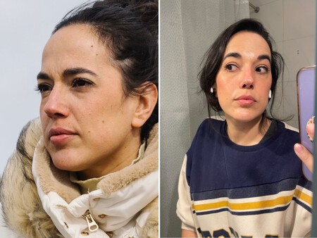 Seis Meses Usando Retinol Efectos Y Aspecto De La Piel 2