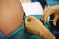 Cómo ayudar a la mujer en el parto con epidural