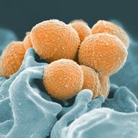 Um passo histórico contra o câncer: cientistas revelam a descoberta que faz bactérias devorarem tumores 