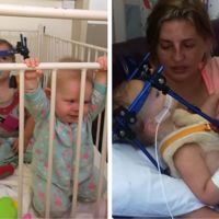 Ambas bebés sufrieron el mismo accidente de coche: la que iba en una silla a contramarcha salió ilesa, la otra sufre graves daños