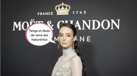 Nariz, pómulos y labios: Victoria Federica se corona como reina del bótox
