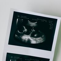 La historia real de un bebé que “durmió” 31 años: fue concebido en 1994, nació en 2025 gracias a una adopción embrionaria cristiana