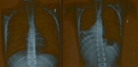 Fisioterapia Vanesa Gonzalez Bullido