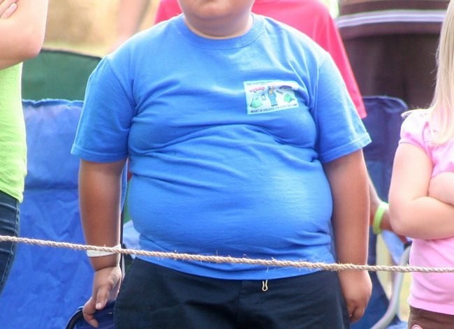 Obesidad infantil niños obesos