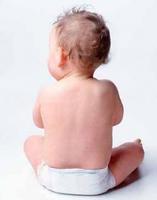 El eccema relacionado con el asma 