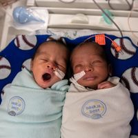 ¡Baby boom gemelar! Una UCIN en Estados Unidos tiene bajo su cuidado a 12 parejas de gemelos y mellizos