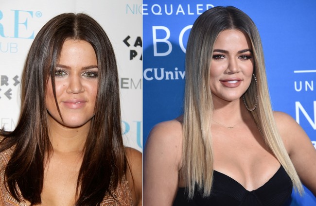 Kardashian Cirugia 04