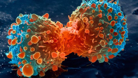 Se creado una prueba universal de cáncer que detecta células mutantes en solo 10 minutos