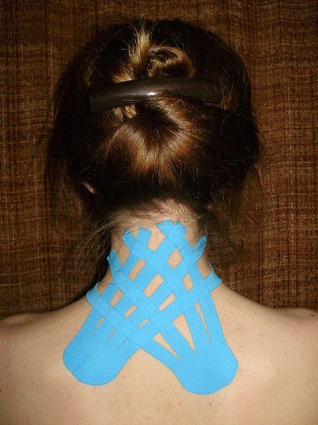 Kinesiotaping ¿Técnica útil o simple placebo?
