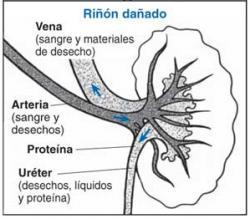 Los peligros de las diestas hiperproteicas