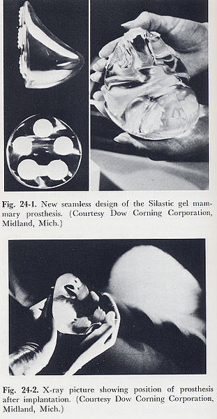 Implantes de silicona