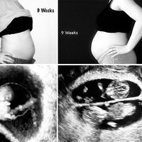 Una madre muestra en fotos las diferencias entre su primer embarazo y el segundo, de gemelos