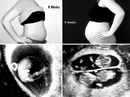 Una madre muestra en fotos las diferencias entre su primer embarazo y el segundo, de gemelos