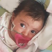 Matilde, la bebé portuguesa con atrofia medular espinal, recibe el medicamento más caro del mundo para frenar la enfermedad