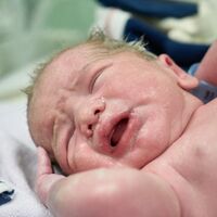 La primera caca del bebé o meconio puede ayudar a predecir si tiene riesgo de desarrollar alergias