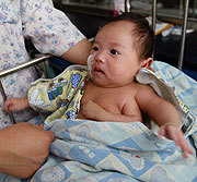 Alarmante aumento de bebés nacidos con malformaciones en China