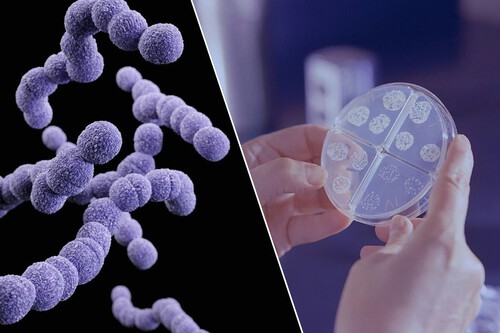 Estudio Vaginosis Bacteriana Es Una Its