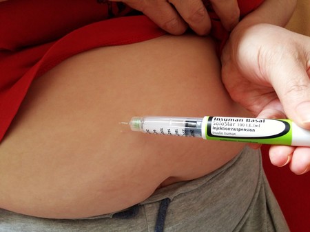 Descubren la causa de que la obesidad provoque enfermedades como la diabetes