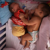 Los gemelos que podrían tener la cura para el virus Zika: uno de ellos nació sano 