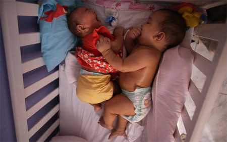 Los gemelos que podrían tener la cura para el virus Zika: uno de ellos nació sano