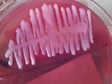 Klebsiella Pneumoniae