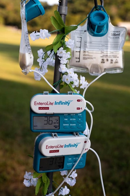bebés alimentados con sonda