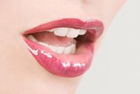 La gingivitis durante el embarazo