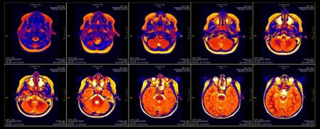 ¿Todos los estudios de los últimos 15 años con resonancia magnética están mal?