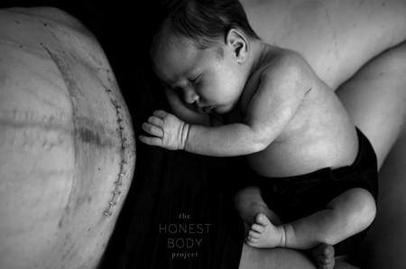 Fotos Cesarea Honest Body 2