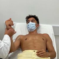 Marc Márquez dice adiós al cabestrillo, comienza con la fisioterapia y ya vislumbra su regreso a MotoGP muy cerca 