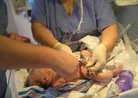 ¿Qué fue de la pinza del cordón?