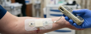 Esqueça a angústia de esperar as feridas cicatrizarem porque a ciência acaba de inventar uma tecnologia incrível que previne infecções