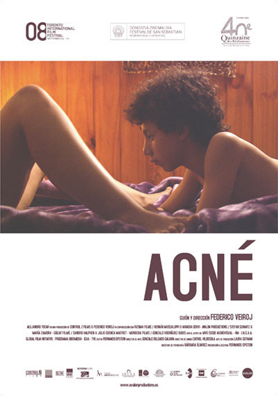 acne poster