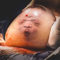 Espectaculares imágenes de partos velados que nos ayudan a imaginar cómo es la vida de un bebé en el útero materno