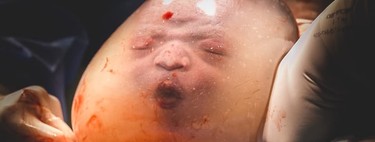 Espectaculares imágenes de partos velados que nos ayudan a imaginar cómo es la vida de un bebé en el útero materno