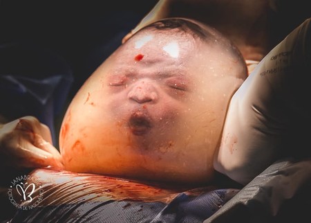 Unas imágenes espectaculares de partos velados nos ayudan a imaginar cómo es la vida de un bebé en el útero materno