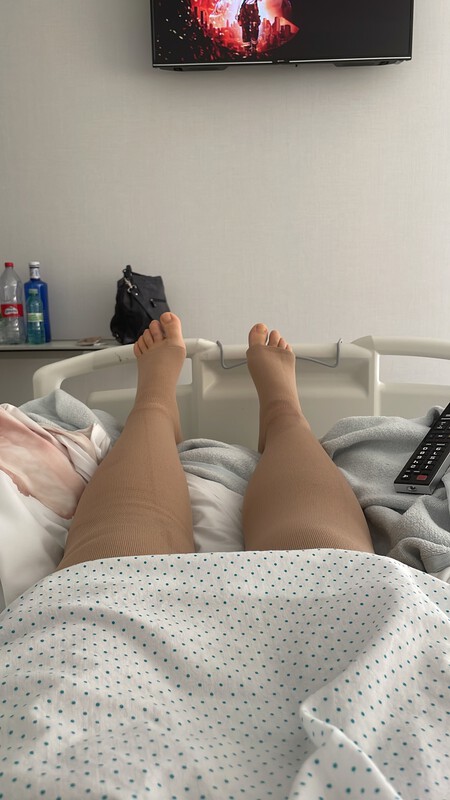 Operacionlipedema