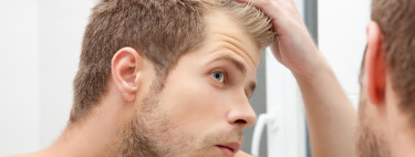 Por qué tu madre tiene pelazo y tu padre se está quedando calvo: las razones por las que la calvicie afecta a unos y no a otros