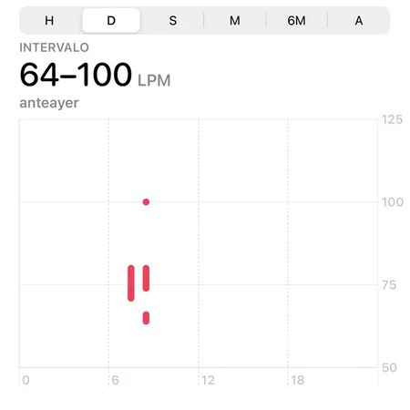 心拍数ウォッチ 1