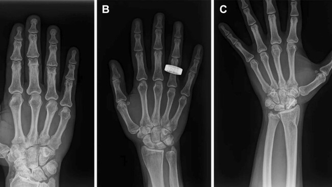 Radiografia
