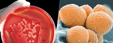 Estreptococo A, la "bacteria caníbal" causante de la enfermedad que está causando alarma en Japón