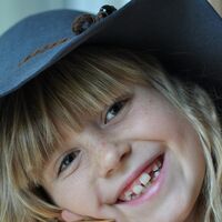 Agenesia dental en niños, o cuando los dientes de leche o definitivos no llegan a desarrollarse: ¿por qué ocurre y cómo se trata?