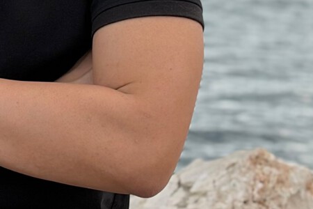 Brazo